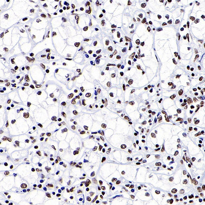 ARID1A Recombinant Rabbit mAb (S-440-27)