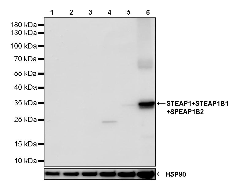 STEAP1+STEAP1B1+STEAP1B2 Recombinant Rabbit mAb (S-3226-137)