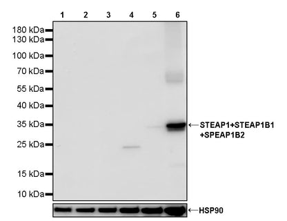 STEAP1+STEAP1B1+STEAP1B2 Recombinant Rabbit mAb (S-3226-137)