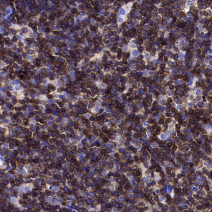 CD45 Recombinant Rabbit mAb (S-3361)