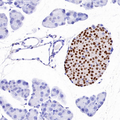 Islet1 Recombinant Rabbit mAb (SDT-2349-17)