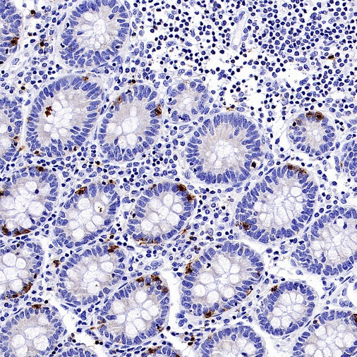CD94 Recombinant Rabbit mAb (S-2616-5)