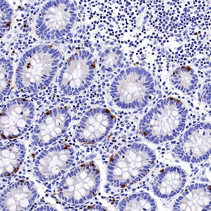 CD94 Recombinant Rabbit mAb (S-2616-5)