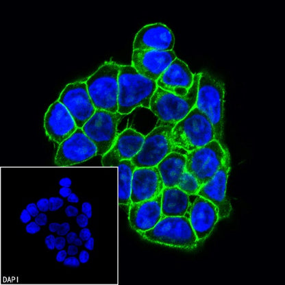 EpCAM Recombinant Rabbit mAb (Alexa Fluor® 488 Conjugate) (S-078-128)