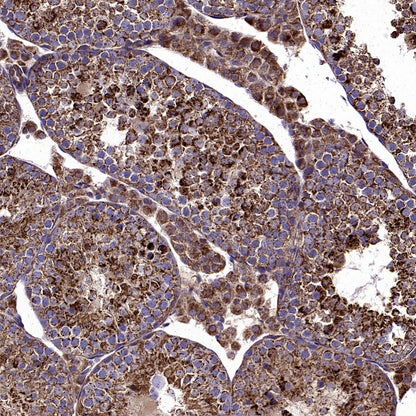 VDAC2 Rabbit Polyclonal Antibody