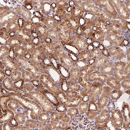 UQCRC2 Recombinant Rabbit mAb (S-2374-127)
