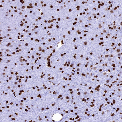 Histone H3 (mono methyl K36) Recombinant Rabbit mAb (S-859-505)