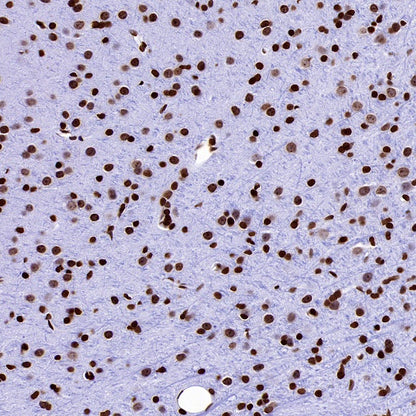 Histone H3 (mono methyl K36) Recombinant Rabbit mAb (S-859-505)