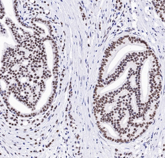 TDP-43 Recombinant Rabbit mAb (S-989-41)