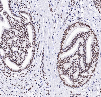 TDP-43 Recombinant Rabbit mAb (S-989-41)