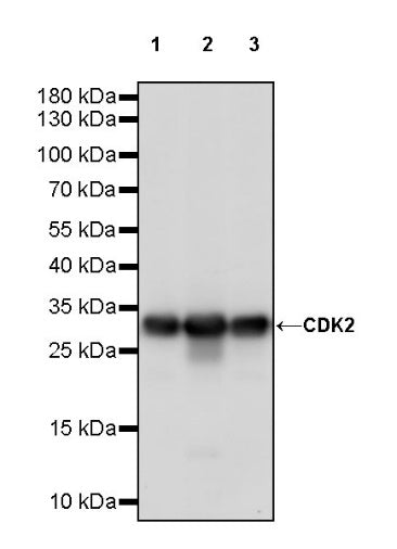 CDK2 Recombinant Rabbit mAb (S-1308-13)