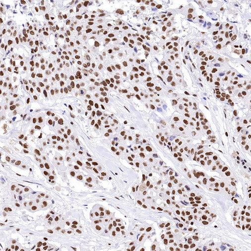 RPA70 Recombinant Rabbit mAb (S-1653-9)
