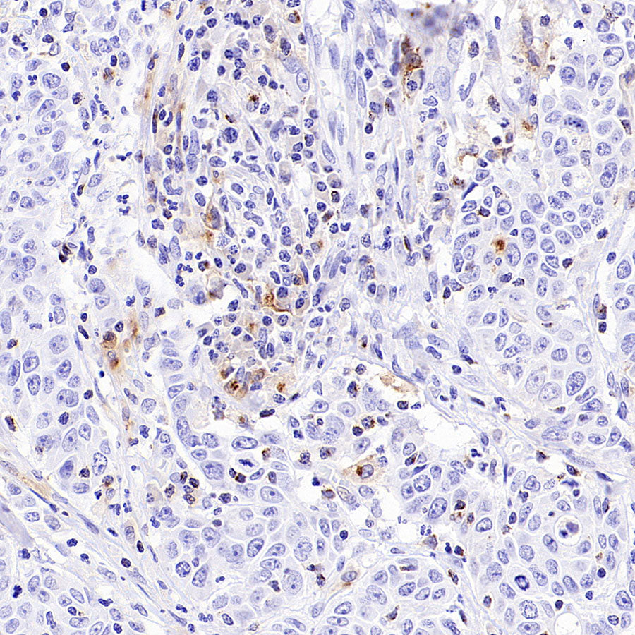 CCL18 Recombinant Rabbit mAb (S-2788-25)