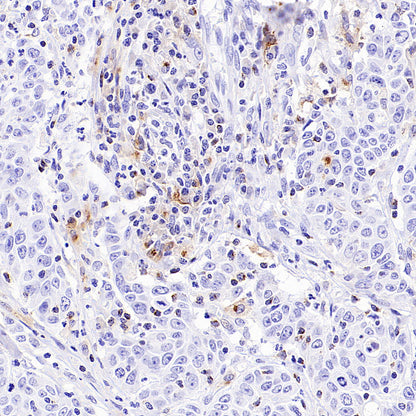 CCL18 Recombinant Rabbit mAb (S-2788-25)