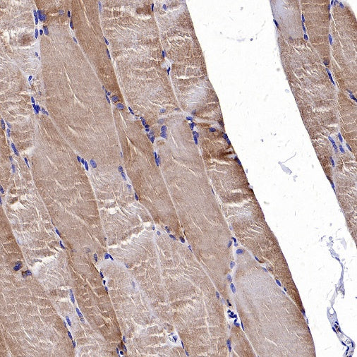 TOM20 Recombinant Rabbit mAb (SDT-2553-11)