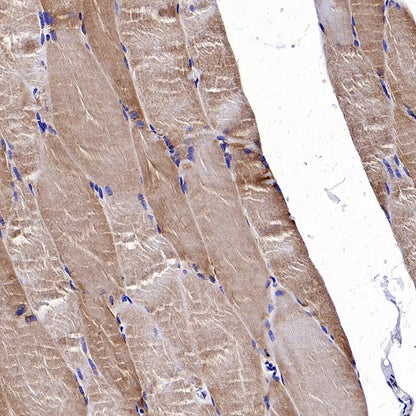 TOM20 Recombinant Rabbit mAb (SDT-2553-11)