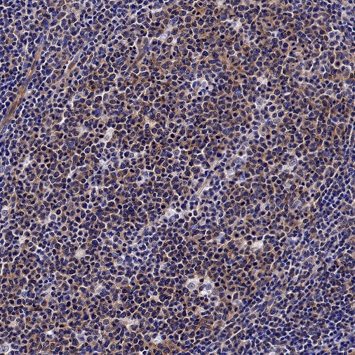 GSK3β Recombinant Rabbit mAb (S-1209-170)