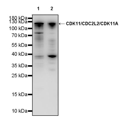 CDK11/CDC2L2/CDK11A Recombinant Rabbit mAb (S-3994-75)