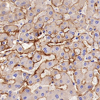 LPA Rabbit Polyclonal Antibody