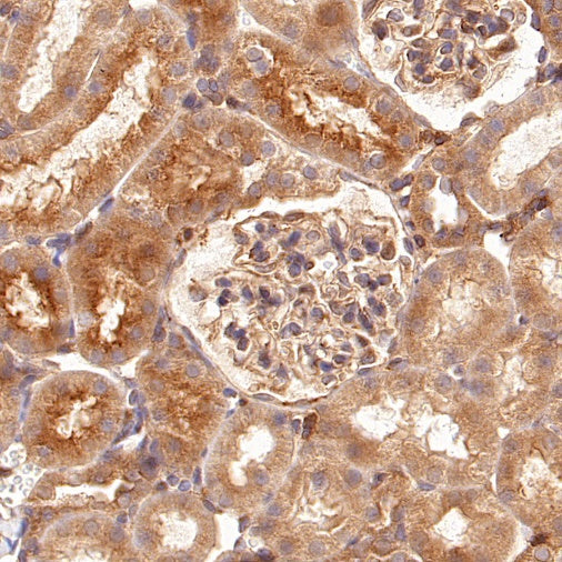 RhoA Recombinant Rabbit mAb (S-1310-159)