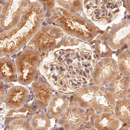 RhoA Recombinant Rabbit mAb (S-1310-159)