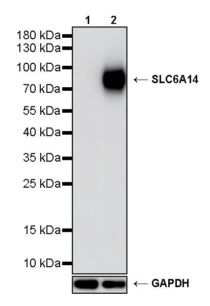 SLC6A14 Recombinant Rabbit mAb (S-5961)