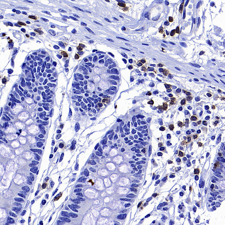 CD127 Recombinant Rabbit mAb (S-4826)