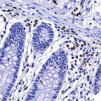 CD127 Recombinant Rabbit mAb (S-4826)