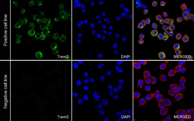 Trem2 Recombinant Rabbit mAb (S-2471-34)