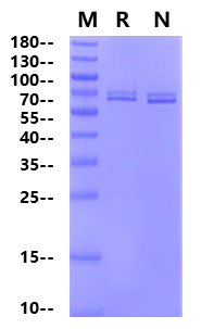 ACVR2B GST Tag Protein, Human