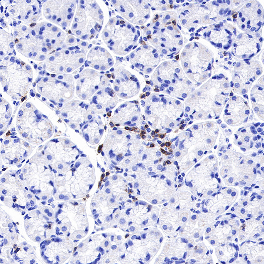 CD3 epsilon Recombinant Rabbit mAb (SDT-241-49)