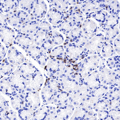 CD3 epsilon Recombinant Rabbit mAb (SDT-241-49)