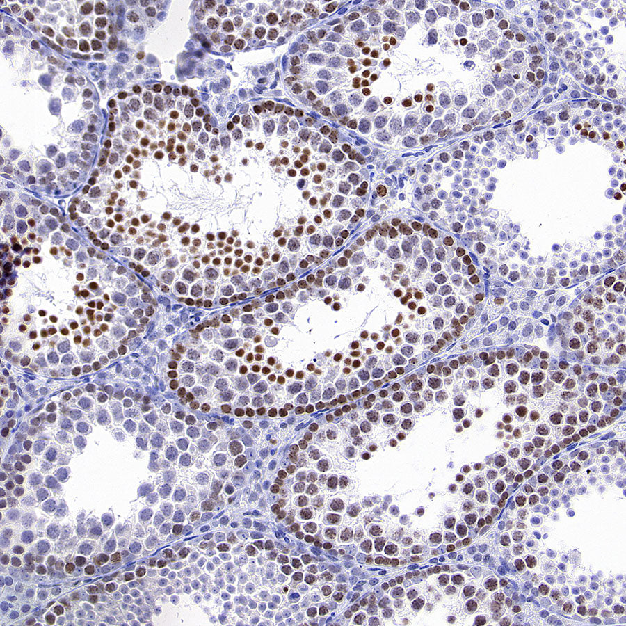 ATAD2 Recombinant Rabbit mAb (S-4145-63)