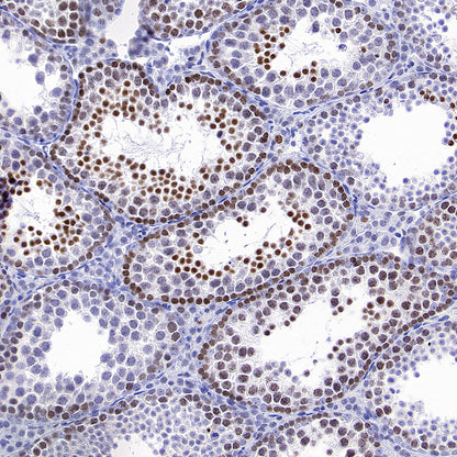 ATAD2 Recombinant Rabbit mAb (S-4145-63)
