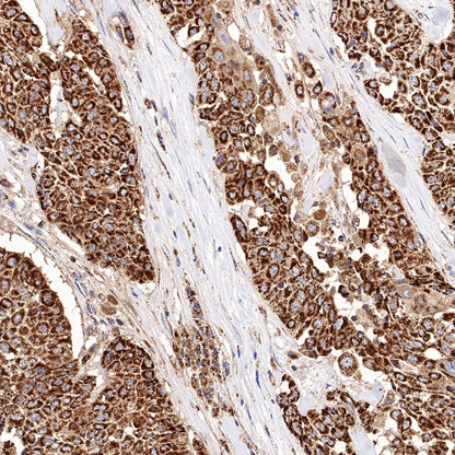 SHMT2/SHMT Rabbit Polyclonal Antibody