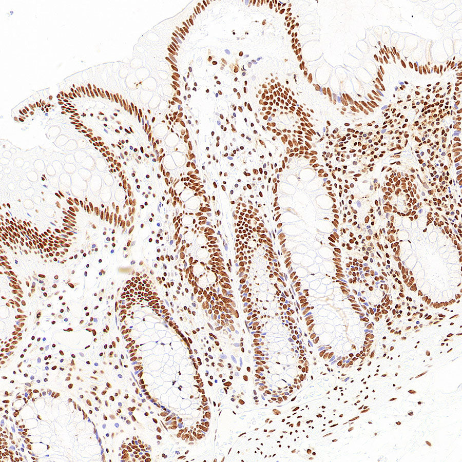 pan Brd4 Recombinant Rabbit mAb (S-6208)