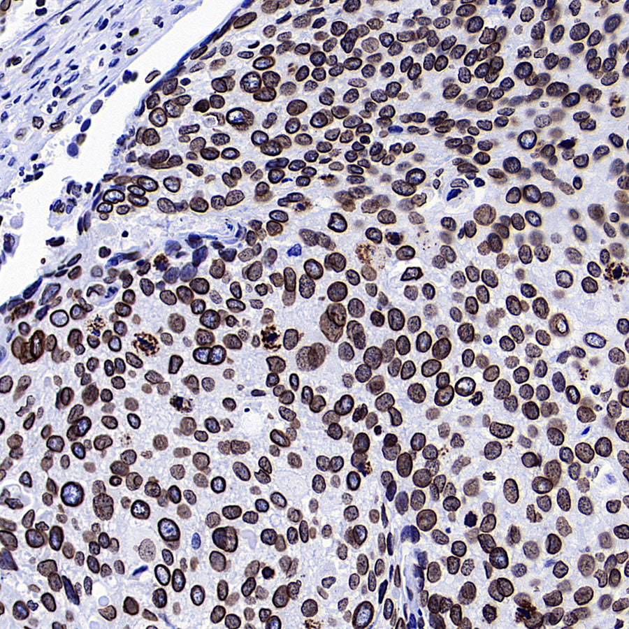 Lamin B1 Recombinant Rabbit mAb (S-5361)