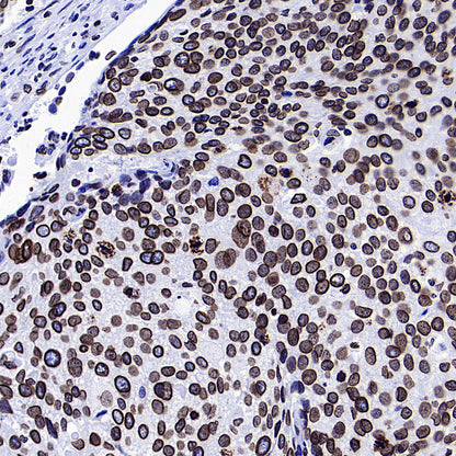 Lamin B1 Recombinant Rabbit mAb (S-5361)
