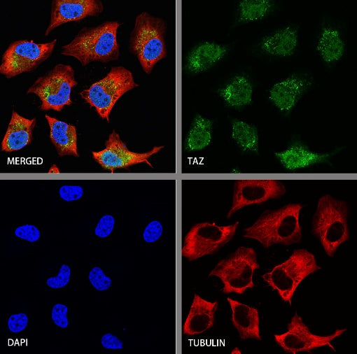TAZ Recombinant Rabbit mAb (S-2812-102)