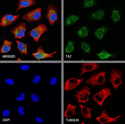 TAZ Recombinant Rabbit mAb (S-2812-102)