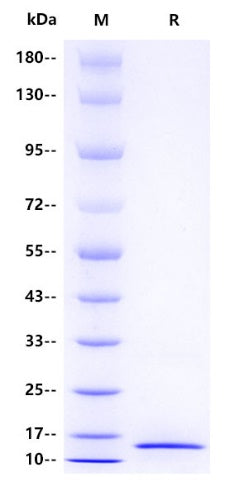 Calprotectin (S100A9) His Tag Protein, Human
