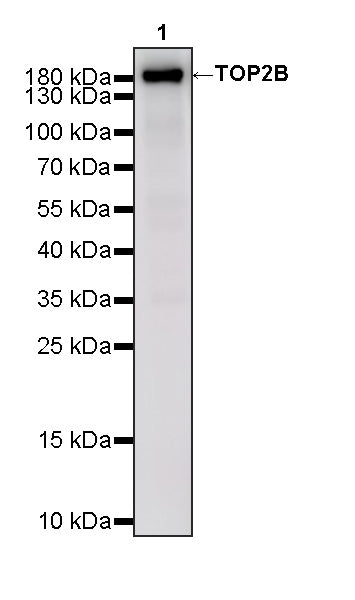 TOP2B Recombinant Rabbit mAb (S-4452-44)