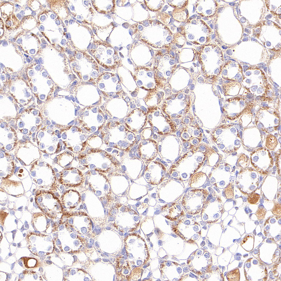 NDUFB8 Recombinant Rabbit mAb (S-4770-29)