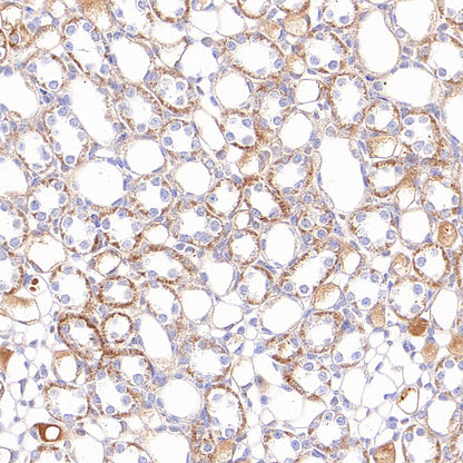 NDUFB8 Recombinant Rabbit mAb (S-4770-29)