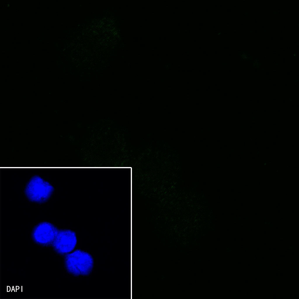 CD36 Recombinant Rabbit mAb,PBS Only (SDT-358-19)