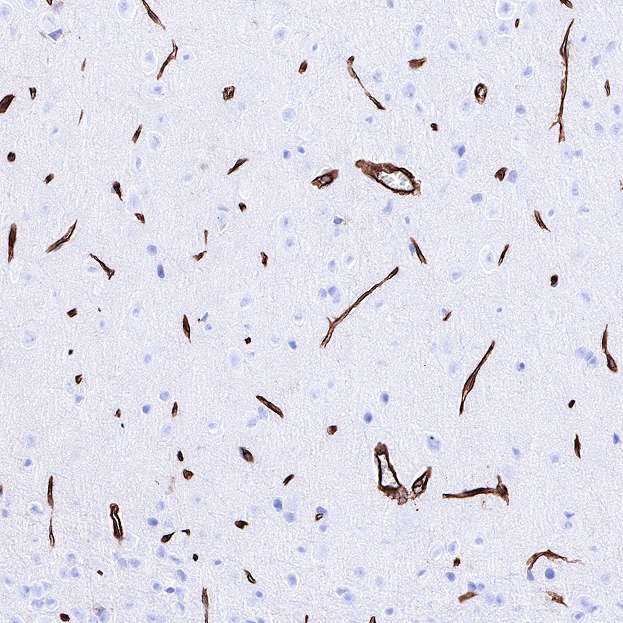 Caveolin-1 Recombinant Rabbit mAb (SDT-065-20)