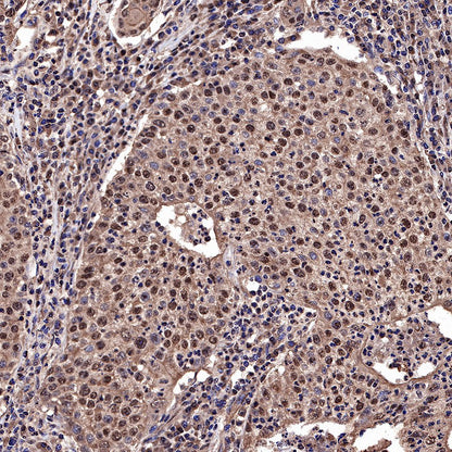 Ubiquitin Rabbit mAb (SDT-R095)