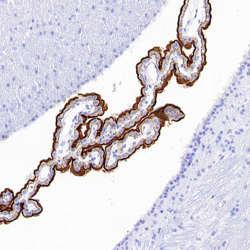 TRPV4 Recombinant Rabbit mAb (S-1746-65)