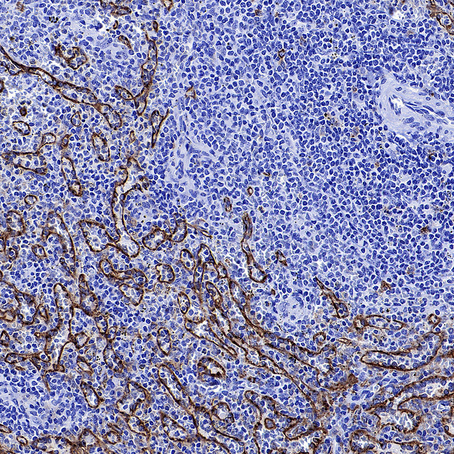 CD206 Recombinant Rabbit mAb (S-3477-27)