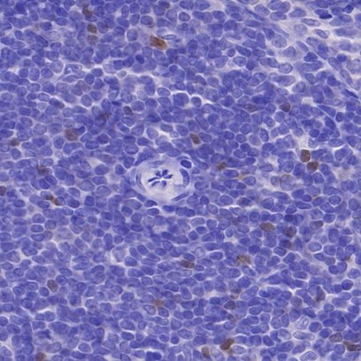 FOXP3 Recombinant Mouse mAb (SDT-3494)